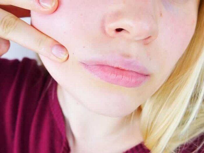 anemia, tonturas e cansaço excessivo são sintomas de falta de ingestão de nutrientes corretos